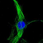 Mouse IgG (H+L) Highly Cross-Adsorbed Secondary Antibody in Immunocytochemistry (ICC/IF)