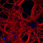 Mouse IgG (H+L) Highly Cross-Adsorbed Secondary Antibody in Immunocytochemistry (ICC/IF)