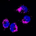 Mouse IgG (H+L) Highly Cross-Adsorbed Secondary Antibody in Immunocytochemistry (ICC/IF)