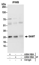 GAMT Antibody in Western Blot (WB)