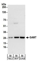 GAMT Antibody in Western Blot (WB)