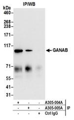 GANAB/Glucosidase II Subunit alpha Antibody in Western Blot (WB)