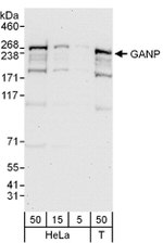 GANP Antibody in Western Blot (WB)