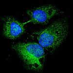 Rabbit IgG (H+L) Highly Cross-Adsorbed Secondary Antibody in Immunocytochemistry (ICC/IF)