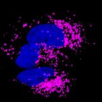 Rabbit IgG (H+L) Highly Cross-Adsorbed Secondary Antibody in Immunocytochemistry (ICC/IF)