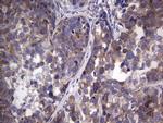 GARS Antibody in Immunohistochemistry (Paraffin) (IHC (P))