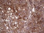 GARS Antibody in Immunohistochemistry (Paraffin) (IHC (P))