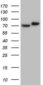 GARS Antibody in Western Blot (WB)