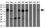 GARS Antibody in Western Blot (WB)