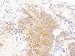 GART Antibody in Immunohistochemistry (IHC)