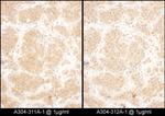 GART Antibody in Immunohistochemistry (IHC)