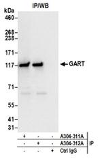 GART Antibody in Western Blot (WB)