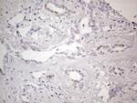 GATA3 Antibody in Immunohistochemistry (Paraffin) (IHC (P))