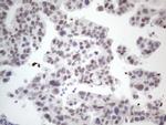 GATA3 Antibody in Immunohistochemistry (Paraffin) (IHC (P))