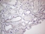 GATA3 Antibody in Immunohistochemistry (Paraffin) (IHC (P))