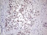 GATA3 Antibody in Immunohistochemistry (Paraffin) (IHC (P))