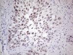 GATA3 Antibody in Immunohistochemistry (Paraffin) (IHC (P))