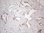 GATA3 Antibody in Immunohistochemistry (Paraffin) (IHC (P))