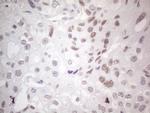 GATA3 Antibody in Immunohistochemistry (Paraffin) (IHC (P))
