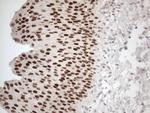 GATA3 Antibody in Immunohistochemistry (Paraffin) (IHC (P))