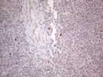 GATA3 Antibody in Immunohistochemistry (Paraffin) (IHC (P))