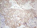 GATA3 Antibody in Immunohistochemistry (Paraffin) (IHC (P))