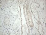 GATA3 Antibody in Immunohistochemistry (Paraffin) (IHC (P))