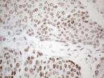 GATA3 Antibody in Immunohistochemistry (Paraffin) (IHC (P))