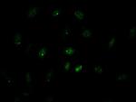 GATA4 Antibody in Immunocytochemistry (ICC/IF)