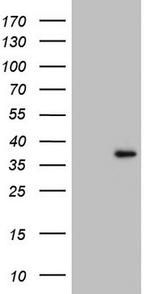 GATAD1 Antibody in Western Blot (WB)