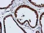 GATM Antibody in Immunohistochemistry (Paraffin) (IHC (P))