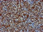 GATM Antibody in Immunohistochemistry (Paraffin) (IHC (P))