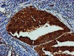 GATM Antibody in Immunohistochemistry (Paraffin) (IHC (P))