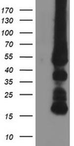 GATM Antibody in Western Blot (WB)