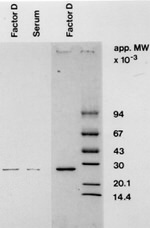 Complement Factor D Antibody in Western Blot (WB)