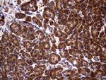 GBA Antibody in Immunohistochemistry (Paraffin) (IHC (P))