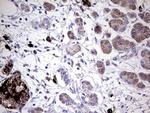 GBA Antibody in Immunohistochemistry (Paraffin) (IHC (P))