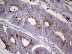 GBA Antibody in Immunohistochemistry (Paraffin) (IHC (P))