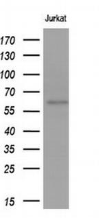 GBA Antibody in Western Blot (WB)