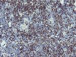 GBA3 Antibody in Immunohistochemistry (Paraffin) (IHC (P))