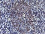 GBA3 Antibody in Immunohistochemistry (Paraffin) (IHC (P))