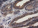 GBA3 Antibody in Immunohistochemistry (Paraffin) (IHC (P))