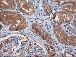 GBA3 Antibody in Immunohistochemistry (Paraffin) (IHC (P))