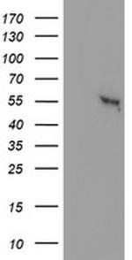 GBA3 Antibody in Western Blot (WB)