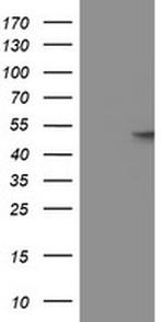 GBA3 Antibody in Western Blot (WB)