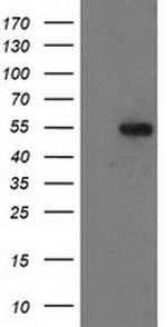 GBA3 Antibody in Western Blot (WB)