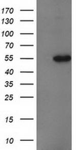 GBA3 Antibody in Western Blot (WB)