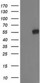 GBA3 Antibody in Western Blot (WB)