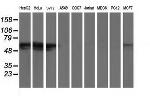 GBA3 Antibody in Western Blot (WB)