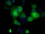 GBE1 Antibody in Immunocytochemistry (ICC/IF)